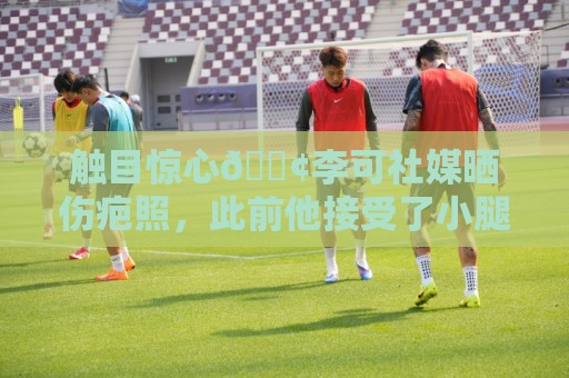 触目惊心😢李可社媒晒伤疤照，此前他接受了小腿血管搭桥手术